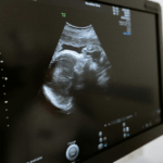 ‘The Pro-Life Movement is Far From Over’